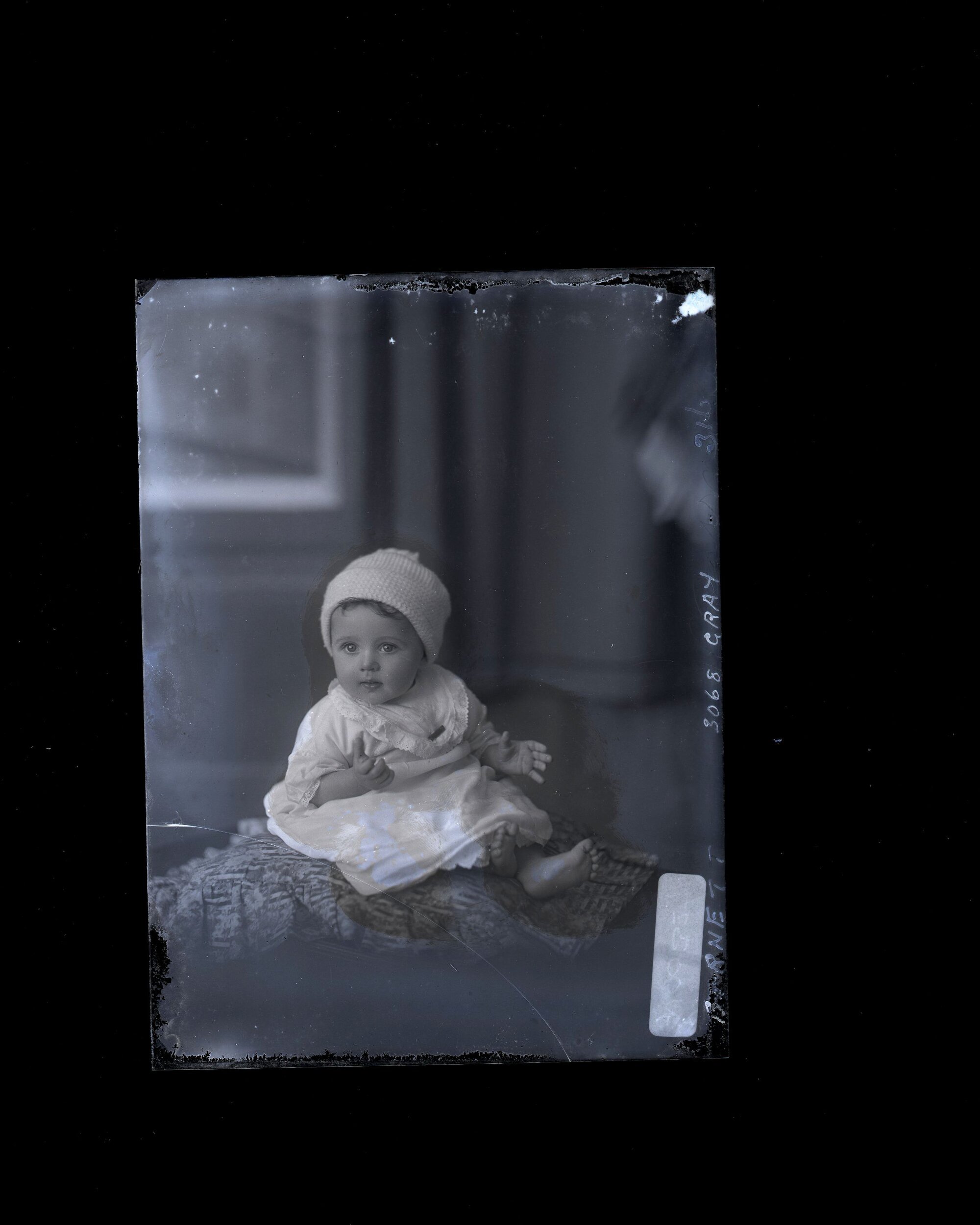 Infant - Burnett