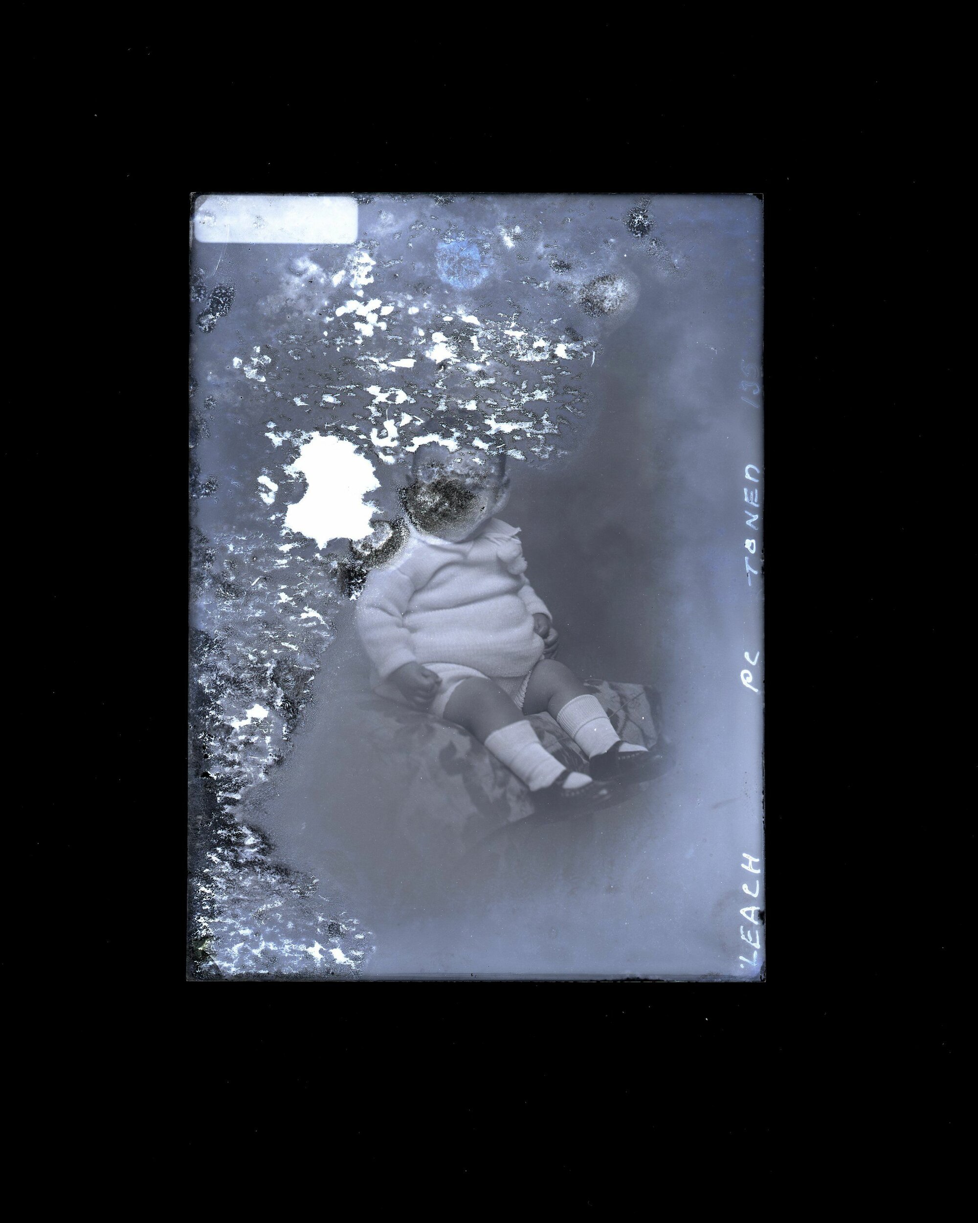 Infant - Leach