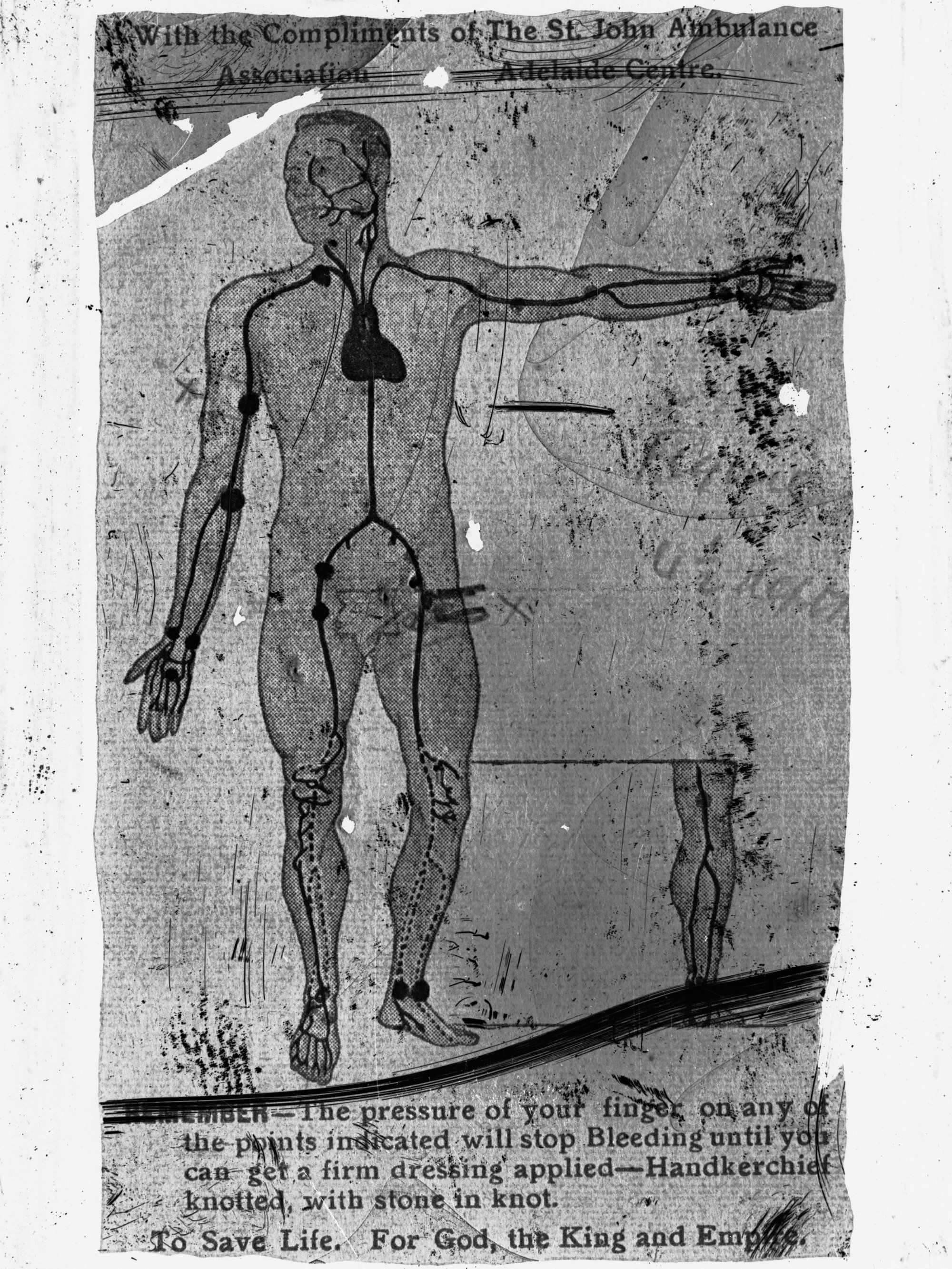 St John Ambulance diagram illustrating using finger pressure to stop bleeding