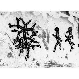Microscopic view of Germs