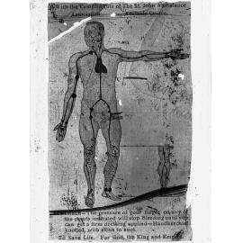 St John Ambulance diagram illustrating using finger pressure to stop bleeding